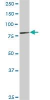 Anti-LRRFIP1 Rabbit Polyclonal Antibody