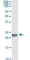 Anti-CD8A Antibody Pair