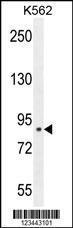 Anti-CLIC6 Rabbit Polyclonal Antibody (APC (Allophycocyanin))