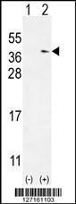 Anti-NME9 Rabbit Polyclonal Antibody (APC (Allophycocyanin))