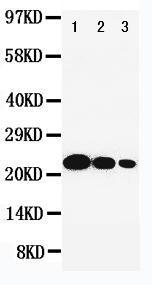 Anti-IL6 Rabbit Polyclonal Antibody