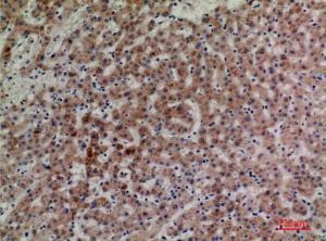 Immunohistochemical analysis of paraffin-embedded human liver using Anti-LILRA4 Antibody