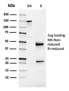 Anti-NKX3.1 antibody