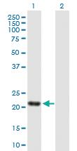 Anti-SENP8 Mouse Polyclonal Antibody