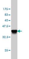 Anti-ATP2A3 Mouse Monoclonal Antibody [clone: 2H3]