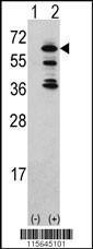 Anti-TNK2 Rabbit Polyclonal Antibody