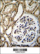 Anti-CELF6 Rabbit Polyclonal Antibody (HRP (Horseradish Peroxidase))