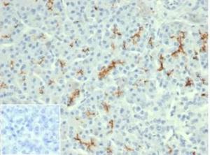 Immunohistochemical analysis of formalin-fixed, paraffin-embedded human pancreas tissue using Anti-CFTR Antibody [rCFTR/6476]. Inset: PBS instead of the primary antibody. Secondary antibody negative control