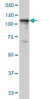 Anti-TYK2 Mouse Monoclonal Antibody [clone: 5A4]