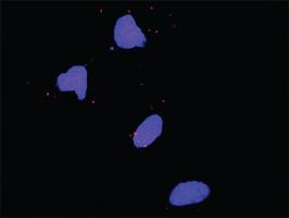 Anti-APC + SIAH1 Antibody Pair