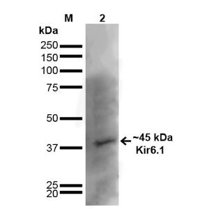 Western blot analysis of rat brain showing detection of ~45 kDa Kir6.1 protein using Anti-Kir6.1 Antibody [S366-60] (A305001) at 1:1,000 for 16 hours at 4°C