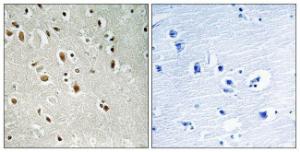 Immunohistochemical analysis of paraffin-embedded human brain using Anti-ANKRD20A3 Antibody. The right hand panel represents a negative control, where the antibody was pre-incubated with the immunising peptide