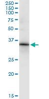 Anti-HOXC8 Mouse Monoclonal Antibody [clone: 1H2]