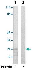 Anti-ANP32C Rabbit Polyclonal Antibody