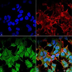 Immunocytochemistry/Immunofluorescence analysis of human neuroblastoma cell line (SK-N-BE, fixed in 4% formaldehyde for 15 min at room temperature, using Anti-Kir6.1 Antibody [S366-60] (A305001), at 1:100 for 60 minutes at room temperature