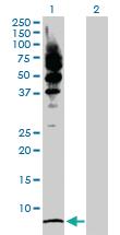 Anti-LRRFIP1 Rabbit Polyclonal Antibody