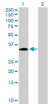 Anti-FGF21 Rabbit Polyclonal Antibody