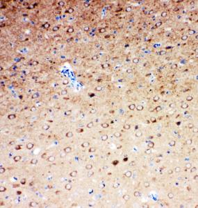 Anti-Serotonin transporter Rabbit Polyclonal Antibody