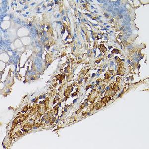 Immunohistochemistry analysis of paraffin-embedded mouse intestin using Anti-c-Kit Antibody (A8390) at a dilution of 1:100 (40x lens). Perform high pressure antigen retrieval with 10 mM citrate buffer pH 6.0 before commencing with IHC staining protocol.