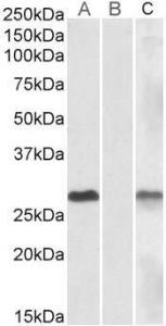 Lane A - Anti-DYDC1 Antibody (A84762) (1 µg/ml) staining of HEK293 overexpressing Human DYDC1 lysate (10 µg protein in RIPA buffer) Lane B - Anti-DYDC1 Antibody (A84762) (1 µg/ml) staining of HEK293 mock-transfected lysate (10 µg protein in RIPA buffer)