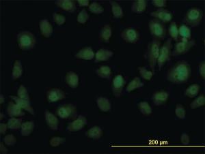 Anti-TYK2 Mouse Monoclonal Antibody [clone: 5A4]