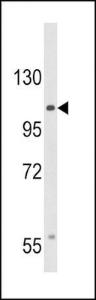 Anti-CACNA2D3 Rabbit Polyclonal Antibody (Biotin)