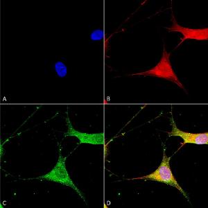 Immunocytochemistry/Immunofluorescence analysis of human neuroblastoma cells (SH-SY5Y), fixed in 4% PFA for 15 min, using Anti-Kir6.1 Antibody [S366-60] (A305001), at 1:100 for overnight at 4°C with slow rocking