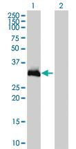 Anti-HOXC9 Mouse Monoclonal Antibody [clone: 2B12]