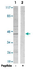 Anti-TBX1 Rabbit Polyclonal Antibody