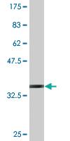 Anti-SLC1A2 Mouse Monoclonal Antibody [clone: 1D8]