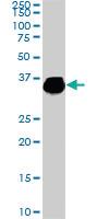 Anti-ELAVL4 Mouse Monoclonal Antibody [clone: 6B9]