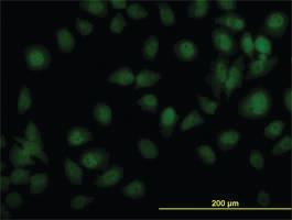 Anti-TYK2 Mouse Monoclonal Antibody [clone: 5A4]