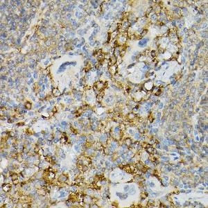 Immunohistochemistry analysis of paraffin-embedded mouse spleen using Anti-c-Kit Antibody (A8390) at a dilution of 1:100 (40x lens). Perform high pressure antigen retrieval with 10 mM citrate buffer pH 6.0 before commencing with IHC staining protocol.