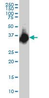 Anti-ELAVL4 Mouse Monoclonal Antibody [clone: 6B9]