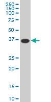 Anti-MEOX2 Mouse Monoclonal Antibody [clone: 5A6]