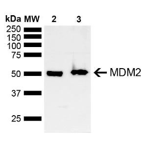 Western blot analysis of mouse, rat brain showing detection of ~40 kDa MDM2 protein using Anti-MDM2 Antibody (A305002) at 1:1000 for 2 hours at room temperature