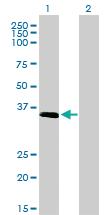 Anti-ELAVL4 Mouse Monoclonal Antibody [clone: 6B9]