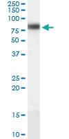 Anti-CPT1A Goat Polyclonal Antibody