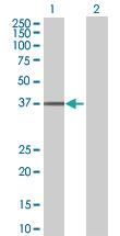 Anti-UBE2Q2 Mouse Polyclonal Antibody