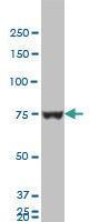 Anti-HNRNPM Mouse Monoclonal Antibody [clone: 3F7]