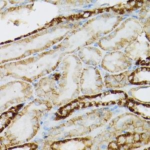 Immunohistochemistry analysis of paraffin-embedded rat kidney using Anti-c-Kit Antibody (A8390) at a dilution of 1:100 (40x lens). Perform high pressure antigen retrieval with 10 mM citrate buffer pH 6.0 before commencing with IHC staining protocol.