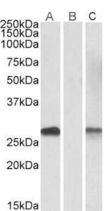 Lane A - Anti-DYDC1 Antibody (A84763) (1 µg/ml) staining of HEK293 overexpressing Human DYDC1 lysate (10 µg protein in RIPA buffer) Lane B - Anti-DYDC1 Antibody (A84763) (0.1 µg/ml) staining of HEK293 mock-transfected lysate (10 µg protein in RIPA buffer).