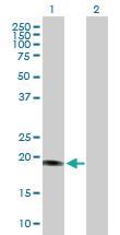 Anti-SENP8 Rabbit Polyclonal Antibody