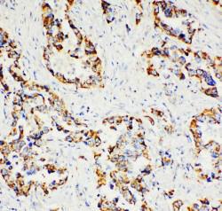 Anti-Paxillin Rabbit Polyclonal Antibody