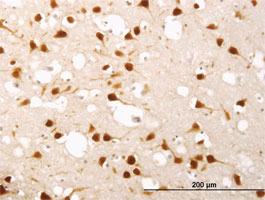 Anti-ELAVL4 Mouse Monoclonal Antibody [clone: 6B9]