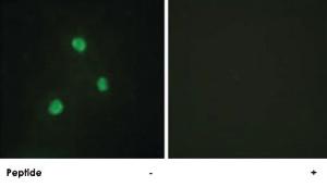 Anti-TBX1 Rabbit Polyclonal Antibody