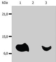 Anti-B2M Mouse Monoclonal Antibody [clone: B2M-01]