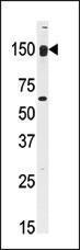 Anti-CLASP2 Rabbit Polyclonal Antibody (AP (Alkaline Phosphatase))