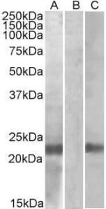 HEK293 lysate (10ug protein in RIPA buffer) overexpressing Human CST8 (RC210130) with C-terminal MYC tag probed with Anti-CST8 Antibody (A84764) (1 µg/ml) in Lane A and probed with anti-MYC Tag (1/1000) in lane C