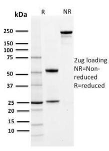 Anti-PD-L1 Mouse Monoclonal Antibody [clone: PDL1/2742]